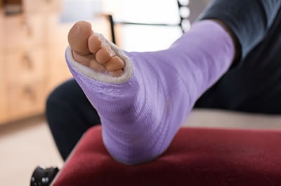 Foot and ankle fractures treatment in the Monmouth County, NJ: Freehold (Manalapan, Carrs Corner, Millstone, Holmeson, Howell, Colts Neck, Marlboro, Spring Valley, Holmdel, Wall) area